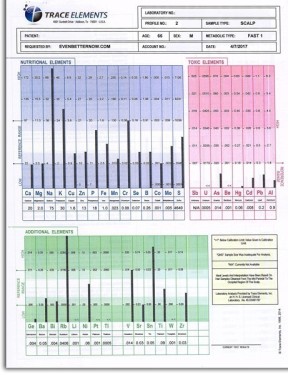 Hair Tissue Analysis Profile 1 - Test 36 Minerals & Toxic Metals